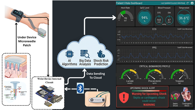 ICU Shock Detection AI